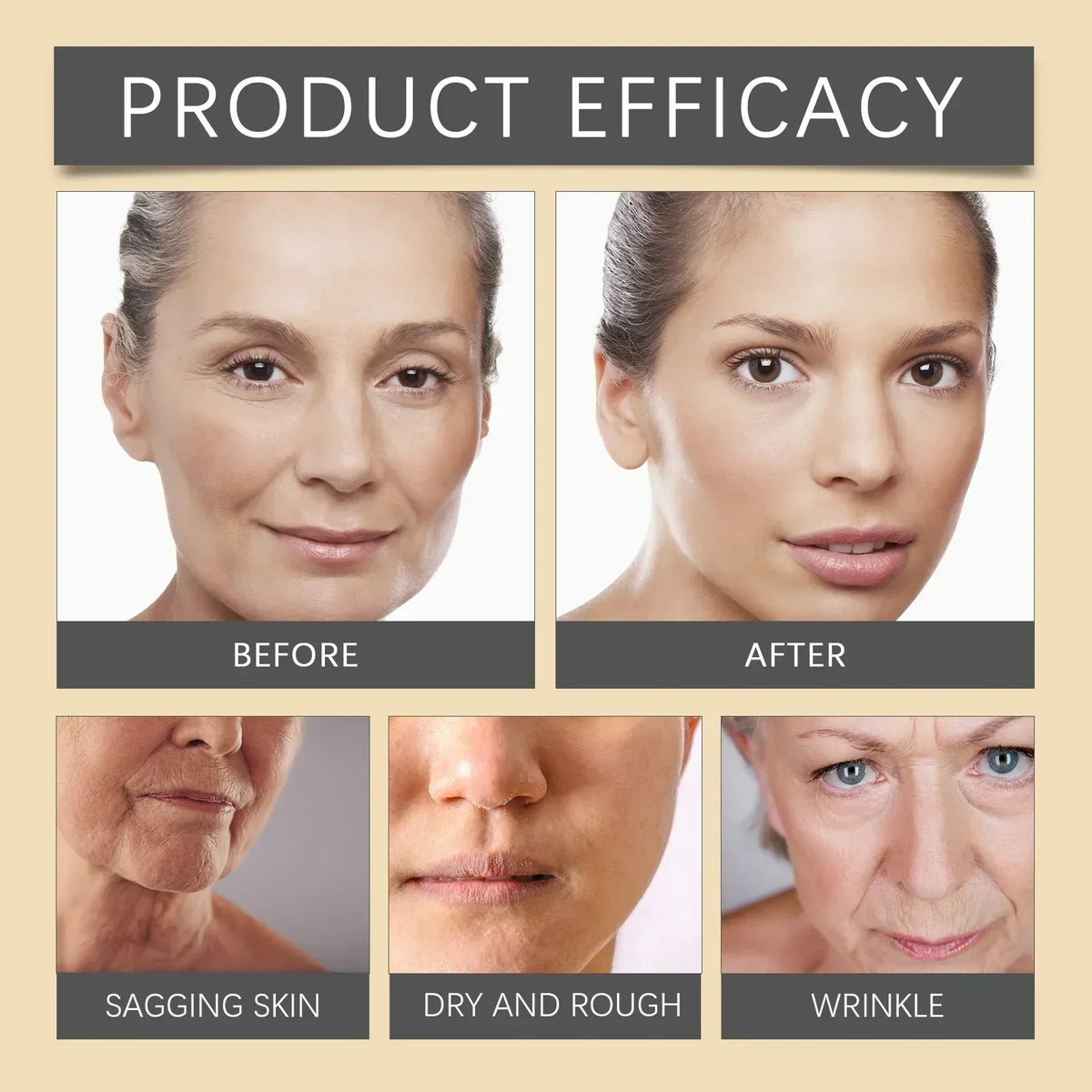 🐝💎 Botox Bee Venom Wrinkle Removal Cream 💎🐝-Shop