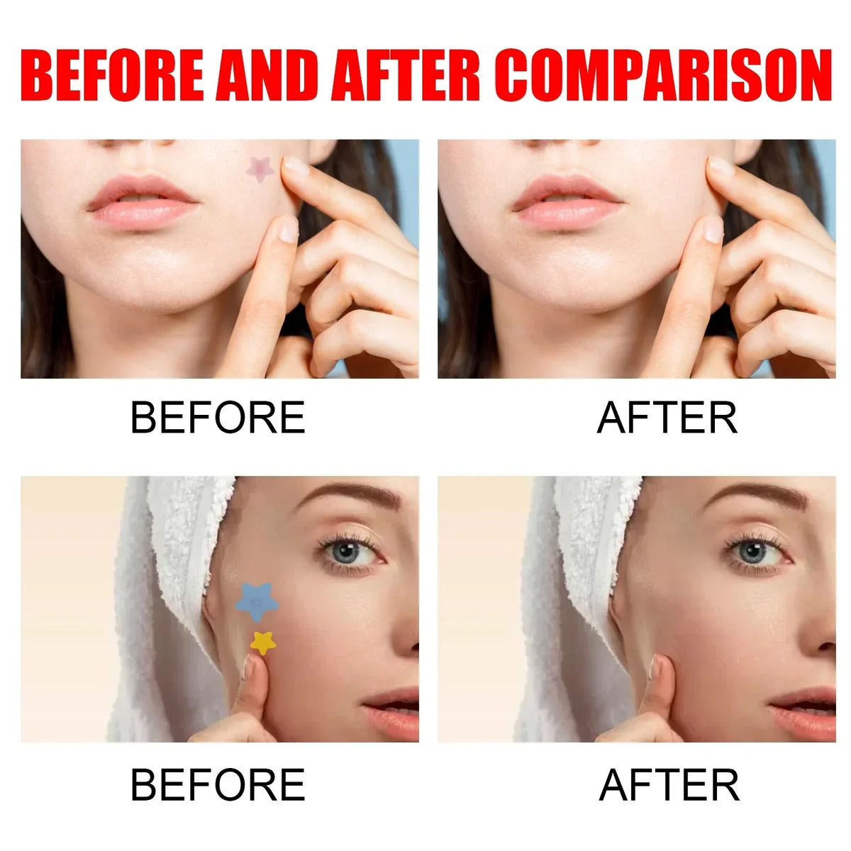 Pimple Patches,Pimple Patches For Face, Hydrocolloid Acne Patches, Cute Star Sti-Shop