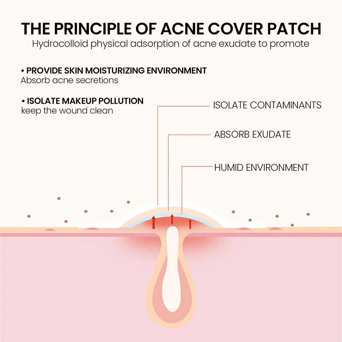 Pimple Patches,Pimple Patches For Face, Hydrocolloid Acne Patches, Cute Star Sti-Shop