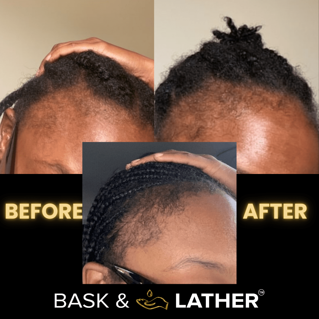 Scalp Stimulator | Hair Growth Oil-Shop
